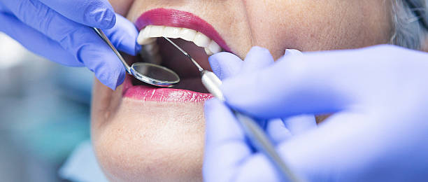 Best Urgent Tooth Repair  in Marble Hill, MO